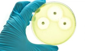 Determinación del perfil de resistencia antimicrobiana de cepas Staphylococcus aureus resistente a la Meticilina (SARM)